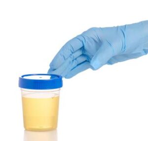 Gloved Hand Holding Urine Sample Collection Cup – Workplace Drug Testing and DOT Urinalysis